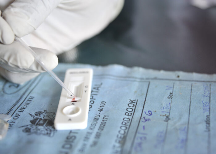 malaria-rapid-diagnostic-test-3-by-doma_nio-pablico-en-usaid-flickr